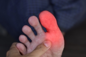 Common Causes of a Swollen Big Toe