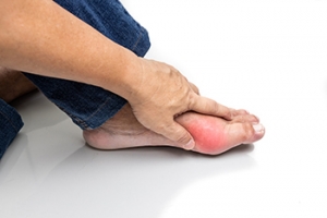 Definition and Key Signs of Gout