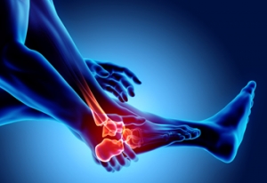Rheumatoid Arthritis Statistics