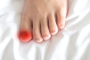 Causes and Risk Factors of Ingrown Toenails