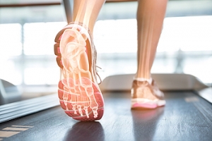 Common Foot Problems