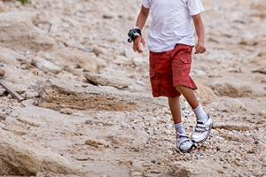 Types of Congenital Foot Disorders
